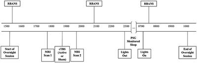 Polysomnographically mediated cognitive improvements in individuals with insomnia symptoms following continuous theta-burst stimulation of the default mode network